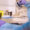 Testes rápidos de antigénio vão continuar a ser comparticipados em setembro