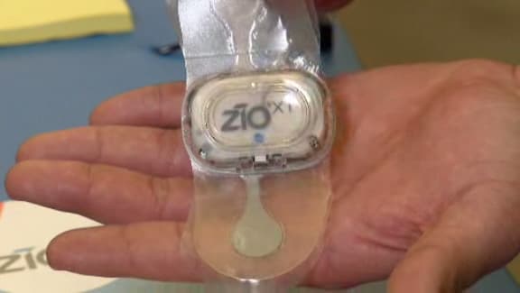 Alphabet Verily, iRhythm working on atrial fibrillation detection